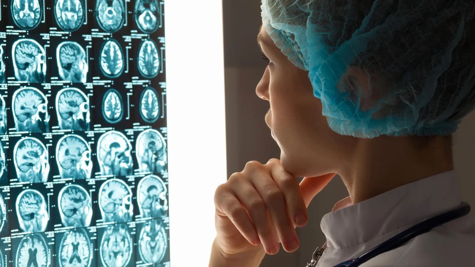 Monitoreo y seguimiento neurofisiológico en Cancún, Q.R.