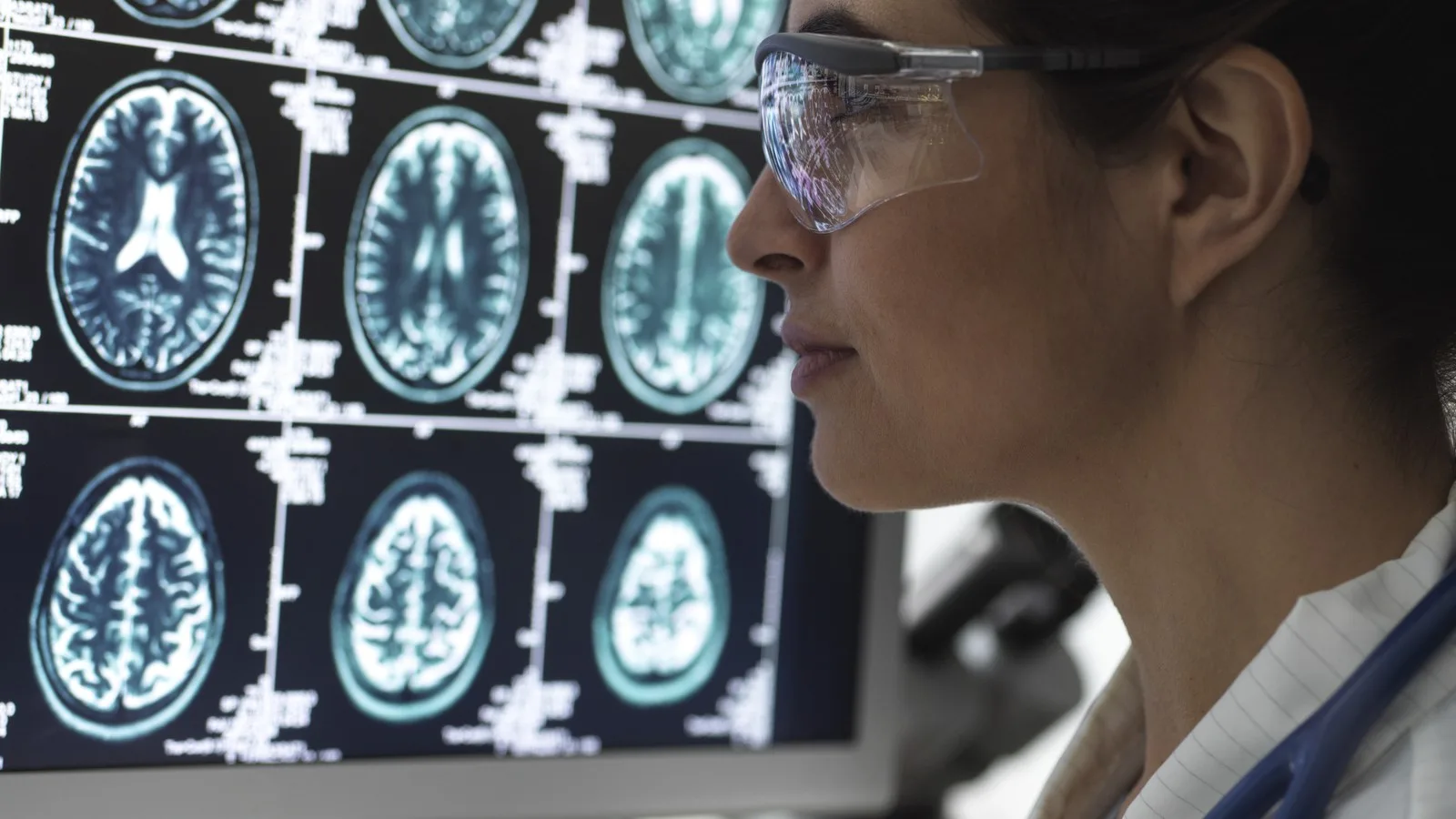 Neurofisiólogo Clínico para Pacientes que Requieren Potenciales Evocados en Cancún, Q.R.