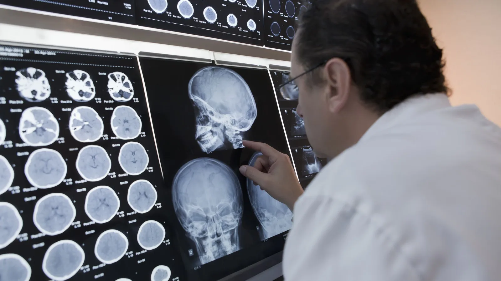 Neurofisiólogo Clínico para Pacientes Referidos por Médicos Internistas en Cancún, Q.R.